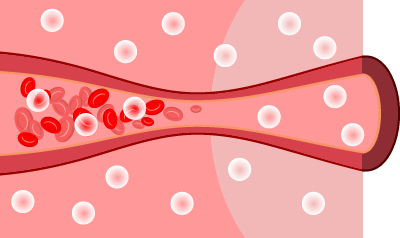 고압 환경에서 고농도의 산소가 조직으로 공급되는 과정
